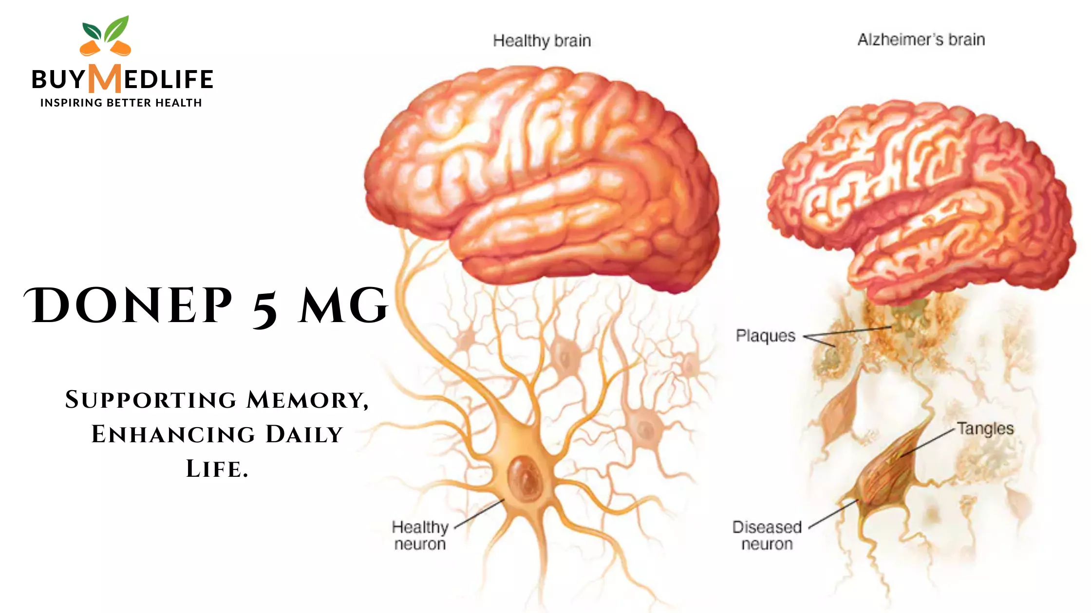 Donep 5 mg Tablets for Cognitive Support