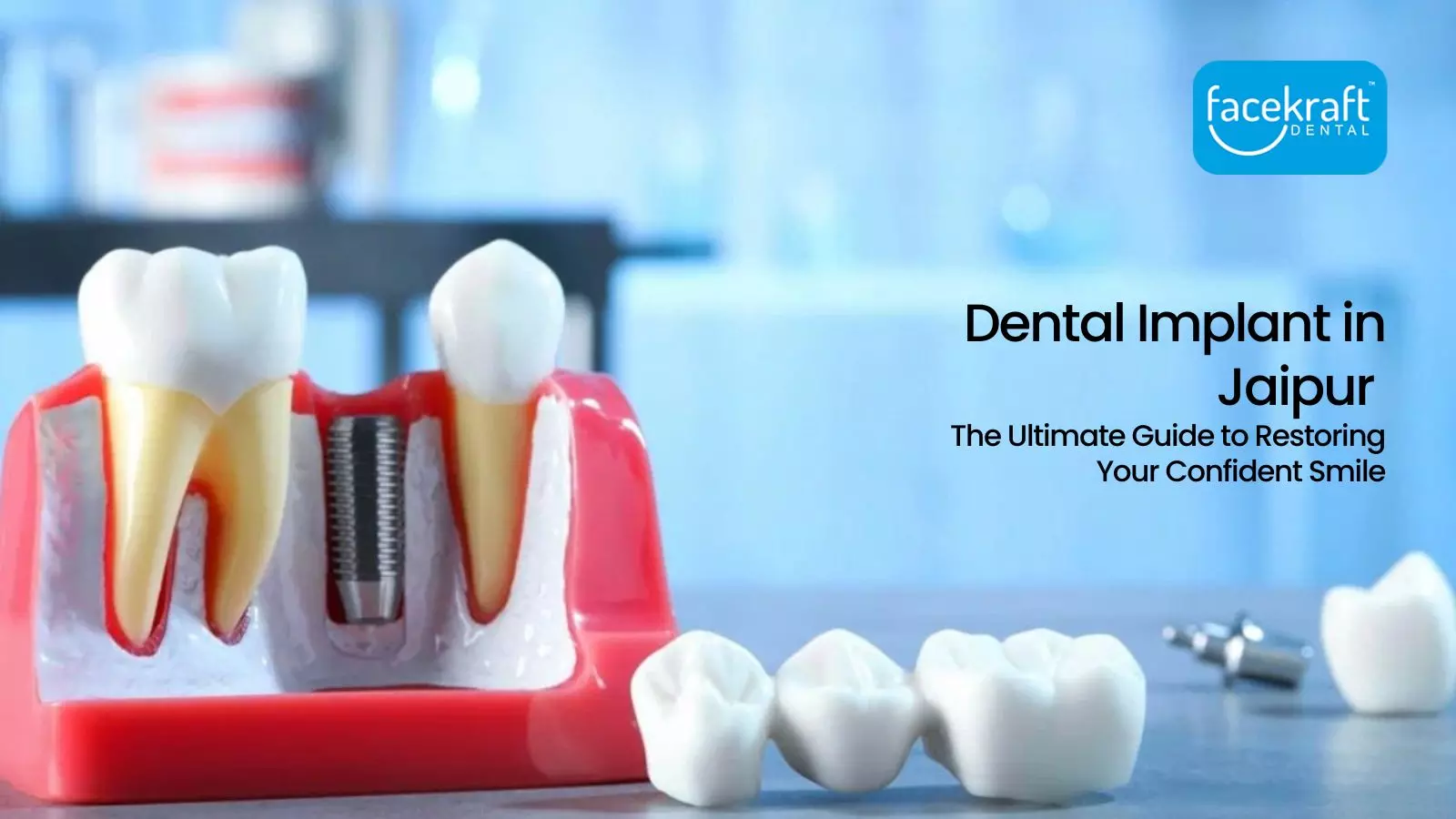 Dental Implant in Jaipur: The Ultimate Guide to Restoring Your Confident Smile