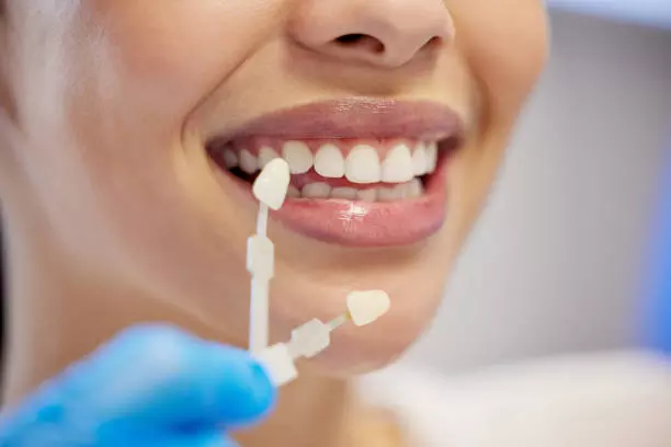 Safety, Risks, and Who Should Avoid Treatment Dental Veneers in Islamabad Pakistan: