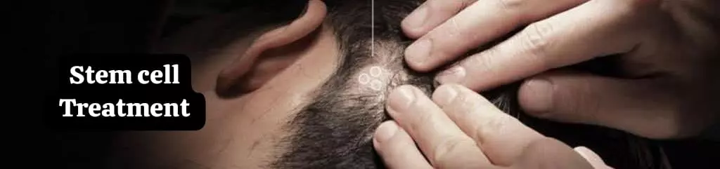 Stem Cell Treatment in Pakistan – Restore, Rejuvenate & Heal Naturally