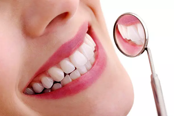 Teeth Whitening Near Me: How to Find the Best Dental Clinic