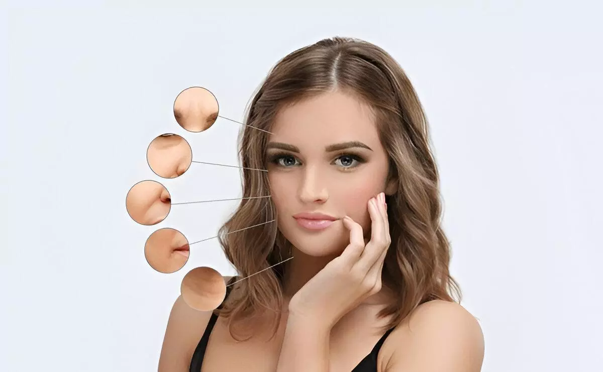 Forehead Contouring Using Dermal Fillers